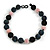Chunky Black/ Pink/ Hematite/ Peacock Glass Beaded Necklace - 57cm Length - view 3