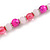 Deep Pink/ Pastel Pink Glass/ Ceramic Bead with Silver Tone Spacers Necklace/ Earrings/ Bracelet Set - 48cm L/ 7cm Ext - view 9