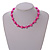 Simulated Pearl and Glass Bead Short Necklace & Bracelet Set in Pink/ 38cm L/ 5cm Ext (Natural Irregularities) - view 5